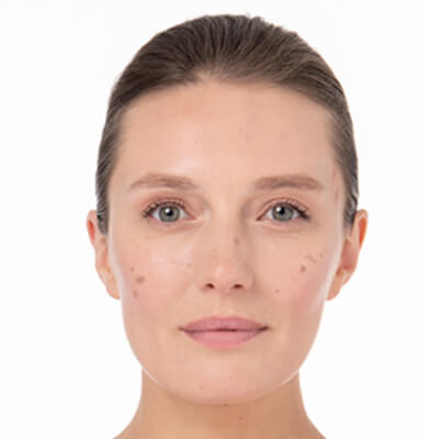 photoderm-akn-mat-yeni