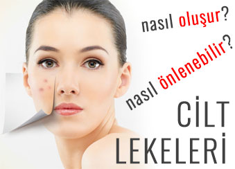 Cilt Lekeleri Neden Oluşur? Nasıl Önlenebilir?