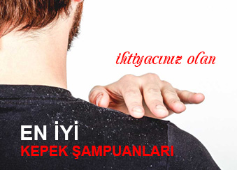 En İyi Kepek Şampuanları Hangileri?