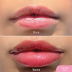 Herbaderm Lip Shine Balm - Candy Girl 10 ml - 3