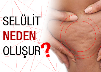 Selülit Neden Olur?